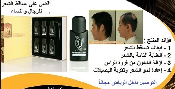 여자 6에 있는 탈모 치료 머리 이주 탈모 처리 탈모 * 50ml
