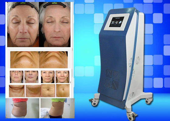 레이저 Lipo 장비 무게를 어는 Cryo는 가정 아름다움 기계를 잃습니다